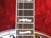 inlays 2