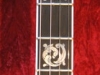 inlays 1