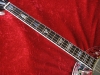 Inlays